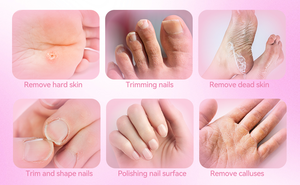 Foot File Nail Grinder