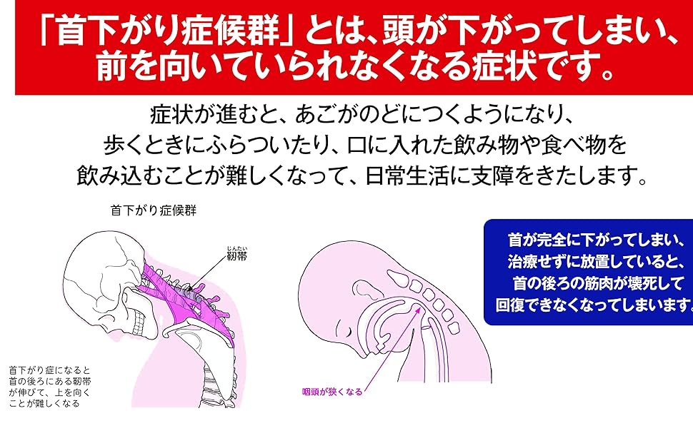 首下がり症候群の診療マニュアル 首下がり症候群診療マニュアルー病態・診断・治療まで : 有隣堂