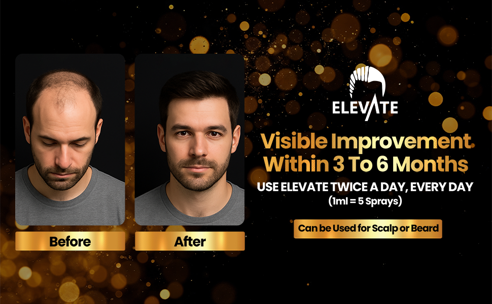 minoxidil for men extra strength