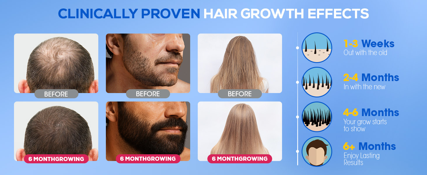 minoxidil for men