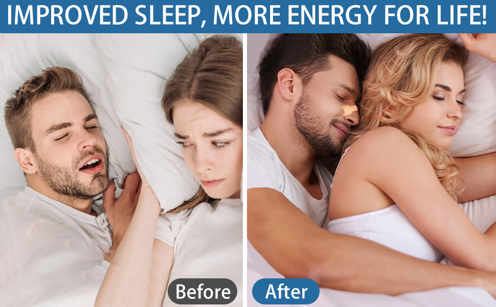 nasal strips to stop snoring