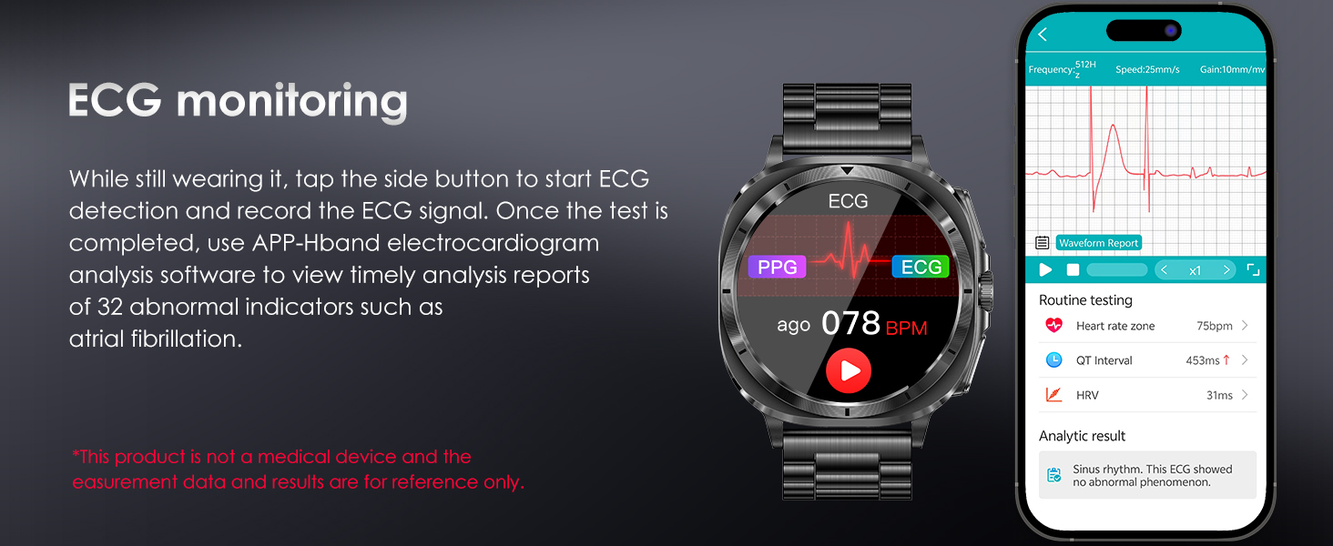 ECG Smartwatch