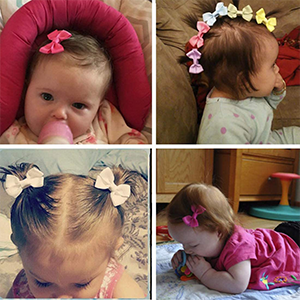 Hair Bow