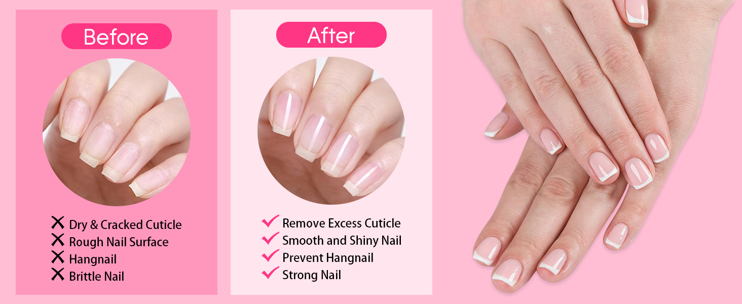 nail care kit