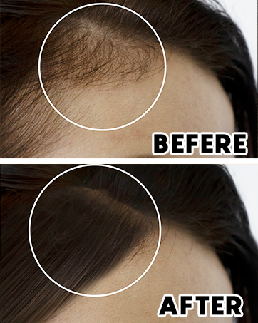 hair oils for hair growth