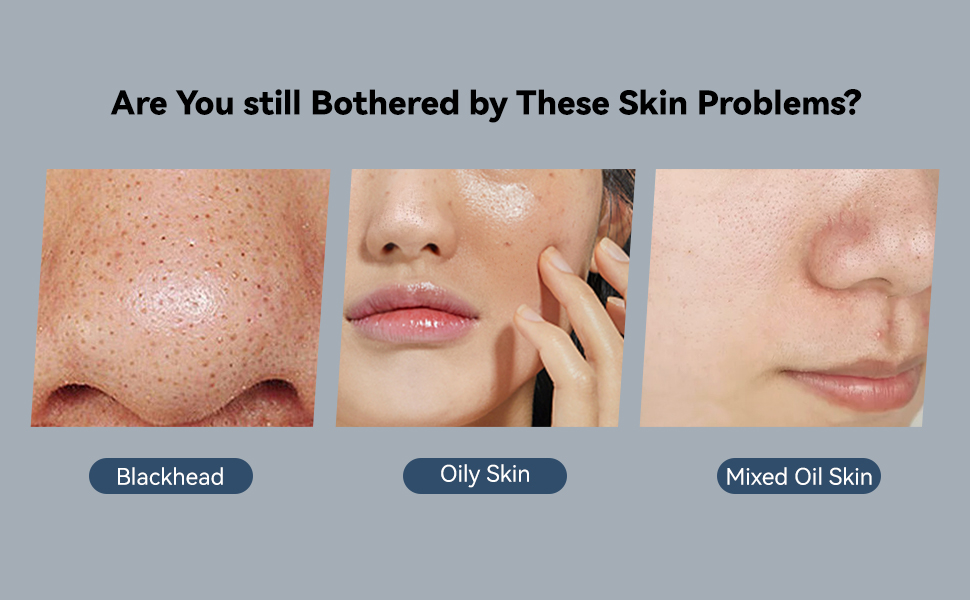Are You still Bothered by These Skin Problems?