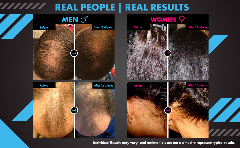 hair growth shampoo treatment anti-dandruff shampoo