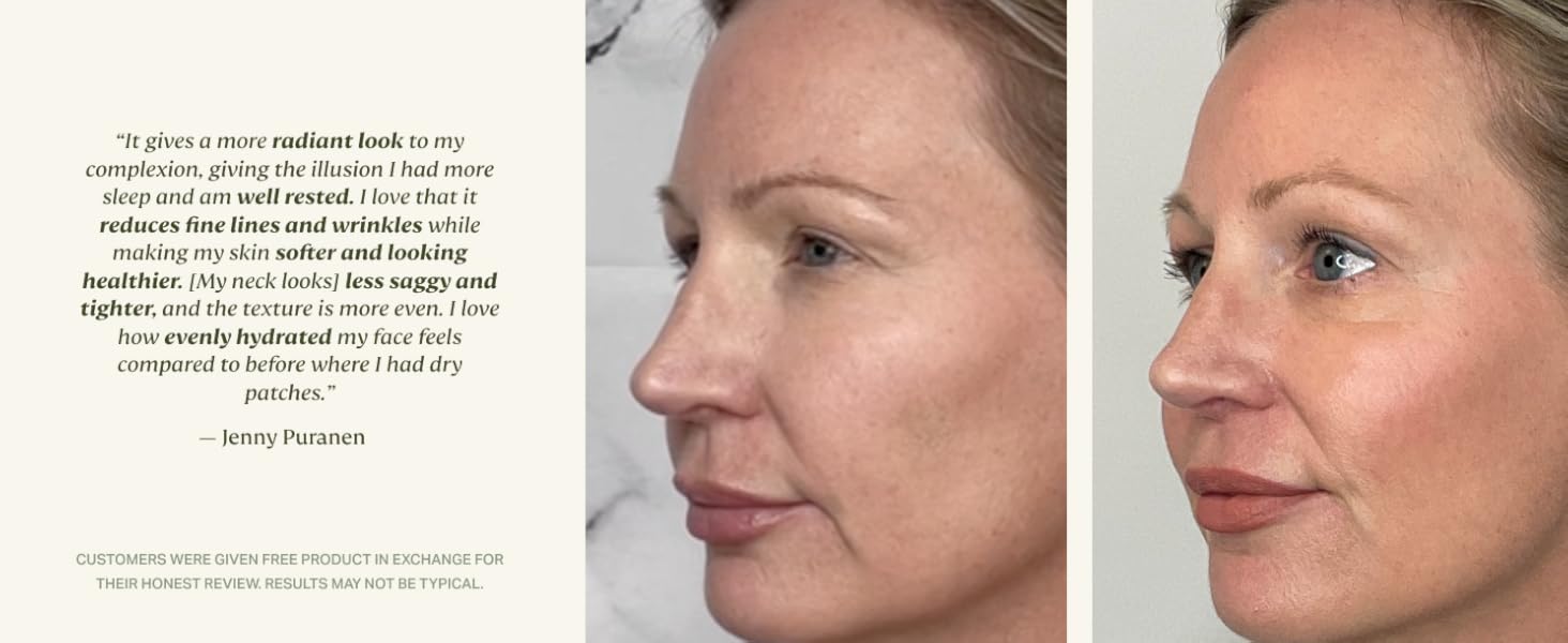 hyaluronic acid