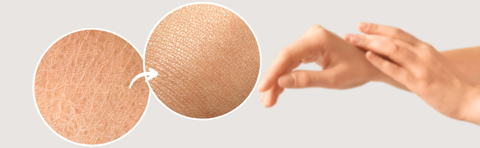 From dry hands to soft and healthy hands