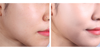 Skin79, k beauty, All skin types, Golden snail BB Cream, Beblesh Balm, Beige, moisturizing