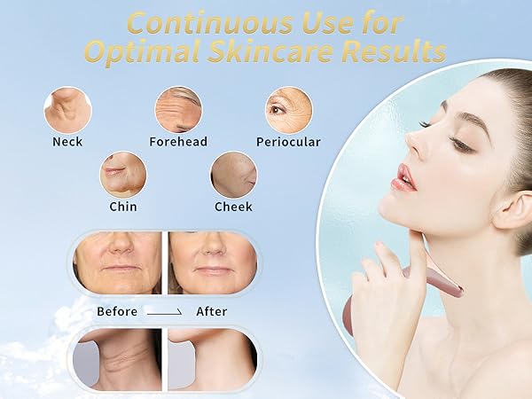 Amazon.com: Facial Beauty Device, Multifunctional Facial