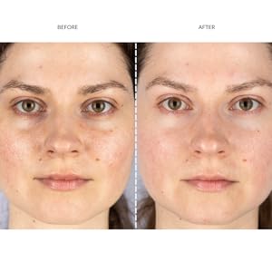 Before and after
