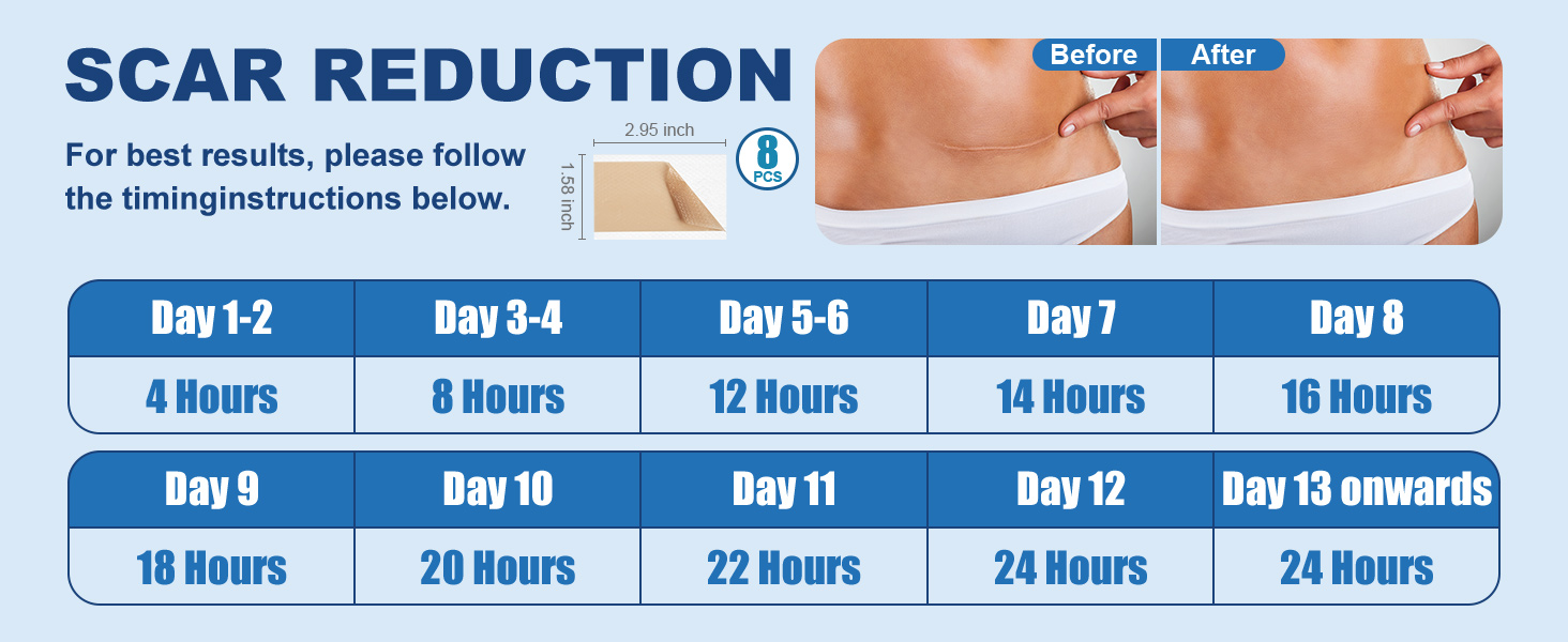 scar away silicone scar sheets