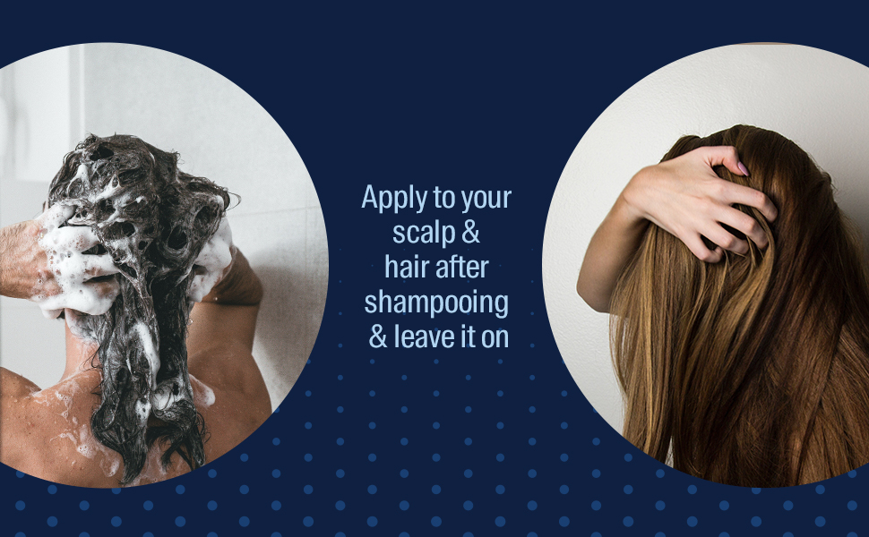 Arata Anti Dandruff Hair Tonic (100 ML) For All Hair Types With Neem, Fenugreek, Tea Tree