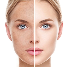 Deep Cleaning - Hydrating - Oil Control