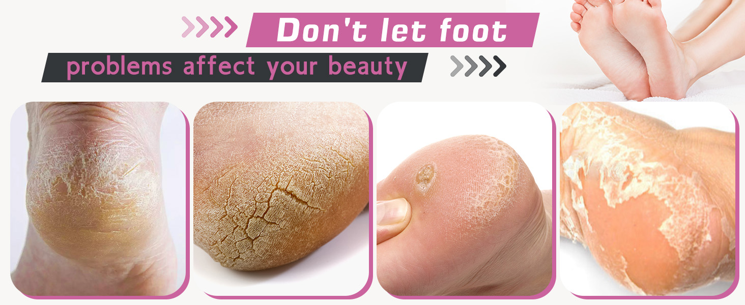 Foot Nail File Grinder Tool