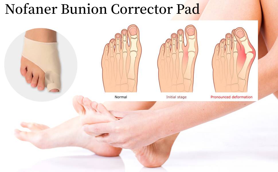 bunion pad