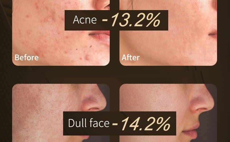 Red Light Face Mask for Home Relaxation