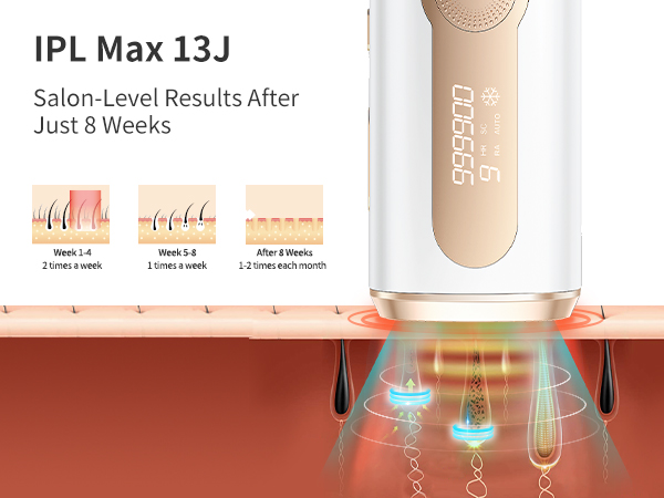 laser hair removal for women permanent