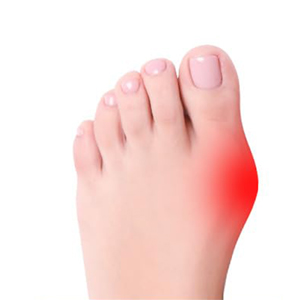 hallux valgus korrektur schiene socken bandage ballenzehen bunion corrector zehenspreizer