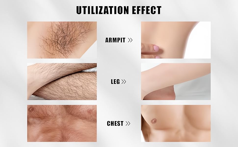Body hair removal