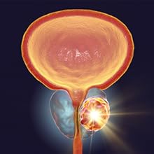 Fördern Sie eine normale Prostatagröße