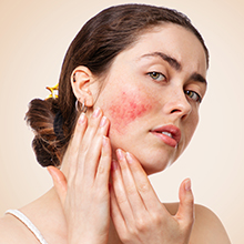 Woman with irritated skin