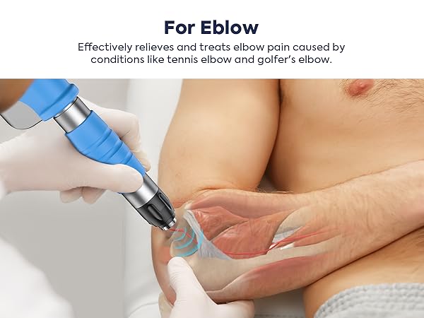 Pain relief for eblow