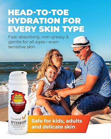 AfterBurn Recovery Lotion