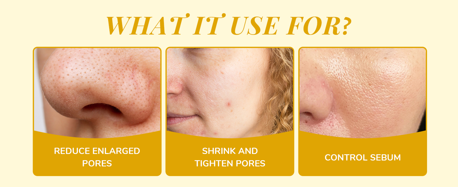 skin concern