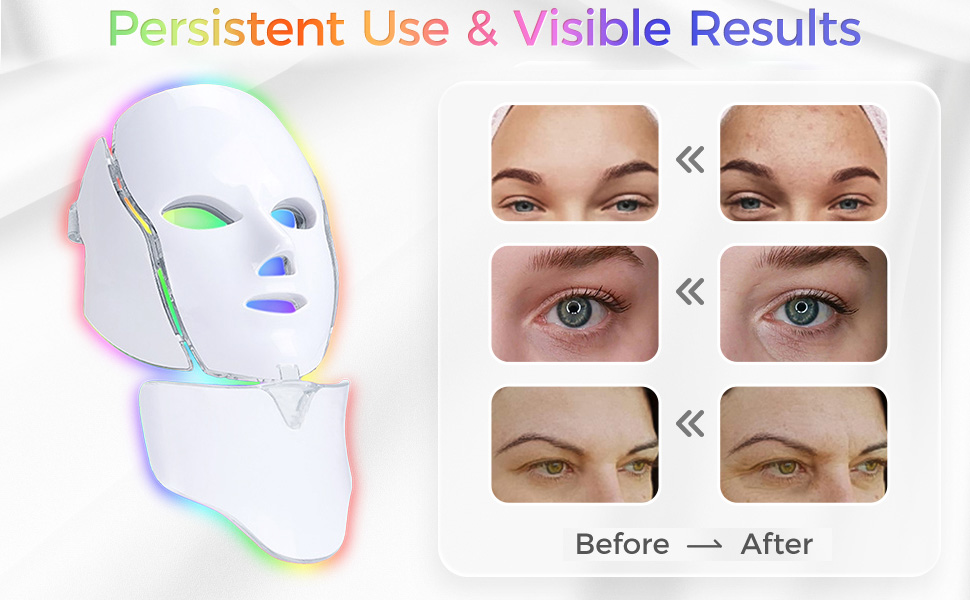 face mask light therapy