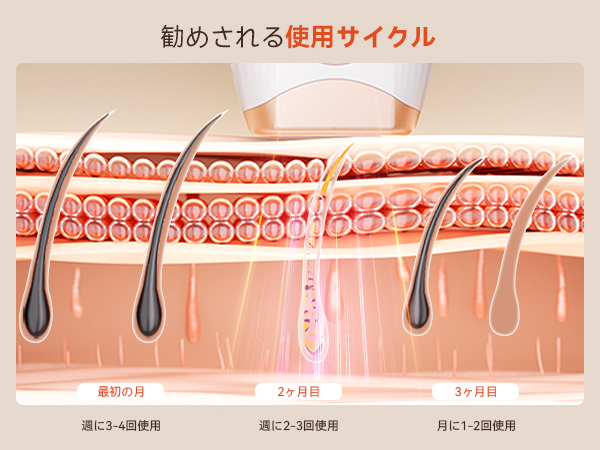 Amazon | YUNDOO家庭用脱毛器 メンズ レディース【IPL 3.0革新的