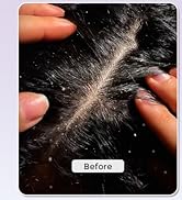 shampoo