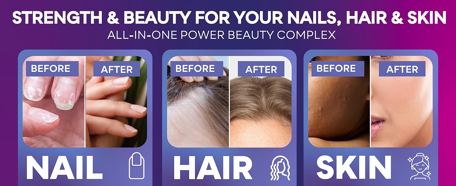 SUNUV biotin 10000mcg collagen supplements for hair growth women