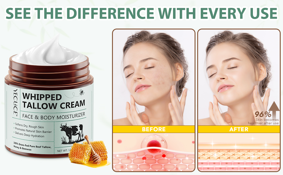 Beef Tallow for Skin, Whipped Tallow & Honey Balm, Organic Tallow Face Moisturizer