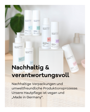 Advies: