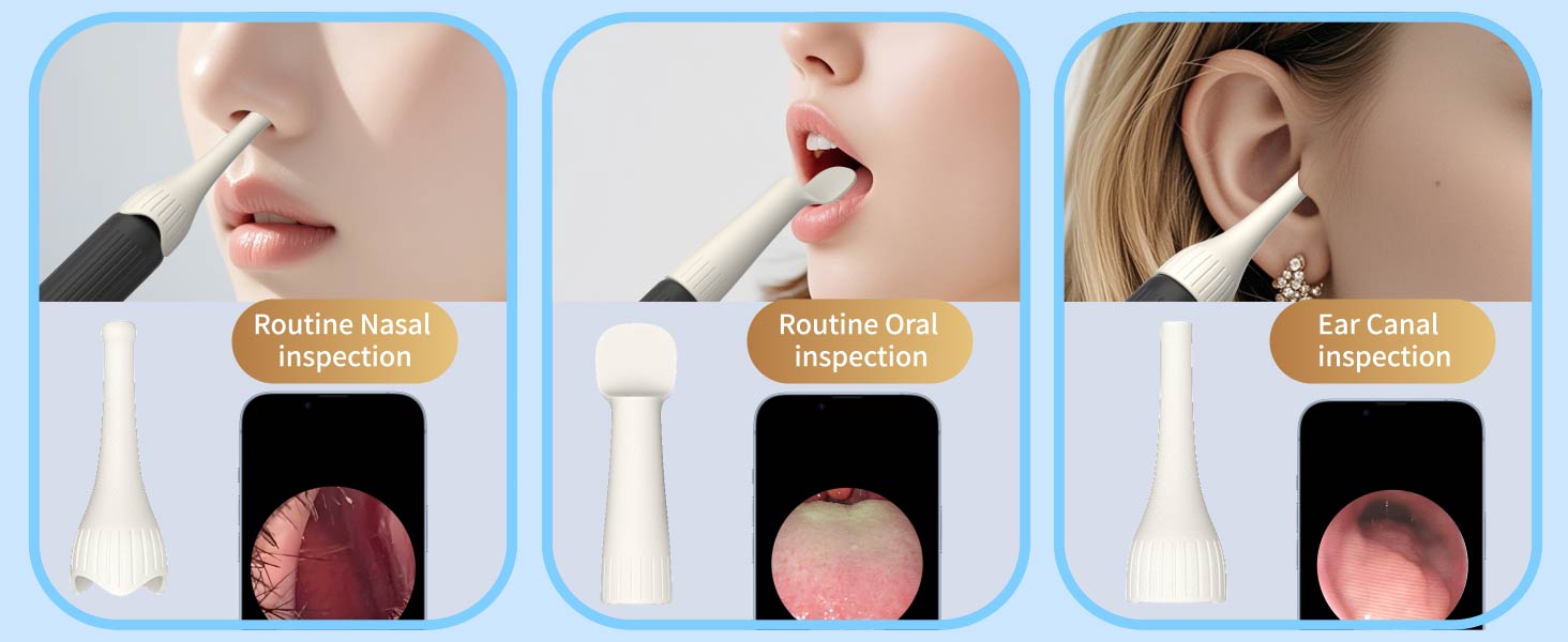 otoscope