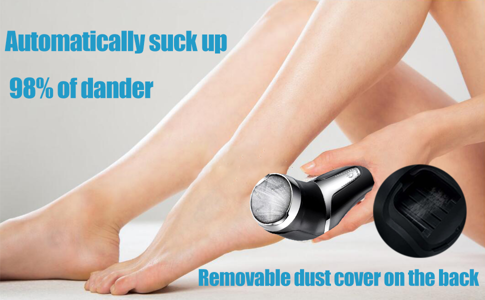 foot callus remover