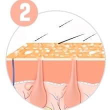 paso 2 de cómo funciona una depiladora láser ipl