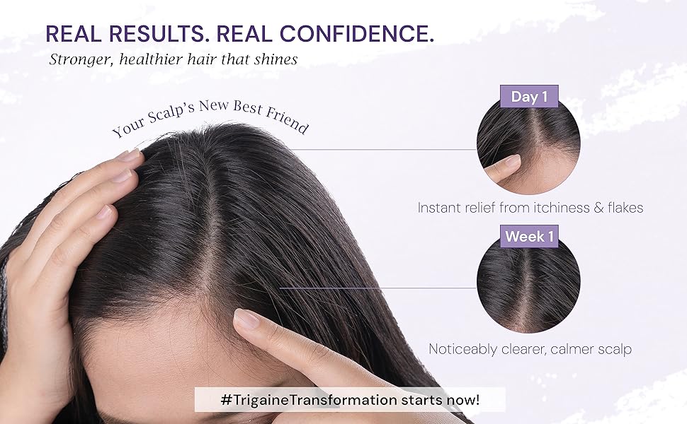 trigaine pro anti dandruff shampoo slide 5