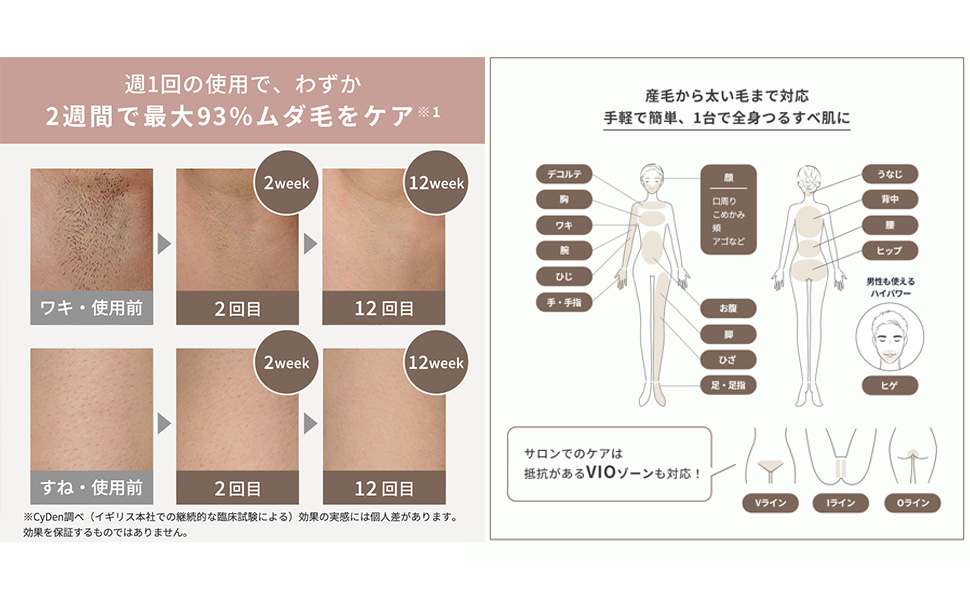 Amazon | スムーズスキン pure SWITCH 脱毛器 レディース VIO対応 VIO