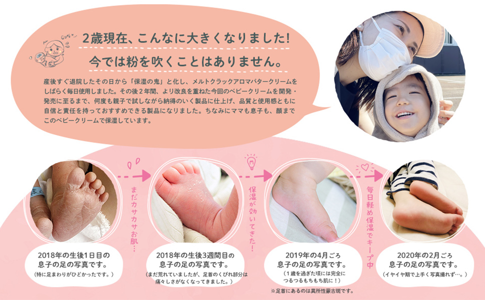 Amazon Co Jp メルトクラック ベビークリーム 新生児 低刺激 敏感肌 ママ 妊婦 無香料 0g アクティフリー ドラッグストア
