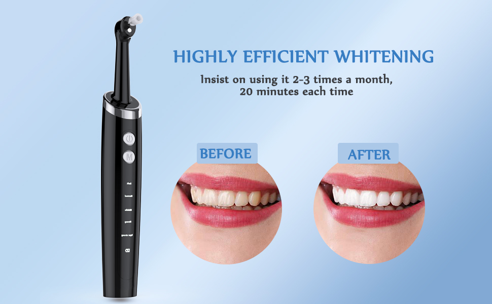 ZoCCee Tooth Polisher, Multifunctional Teeth Whitening Kit for Tooth