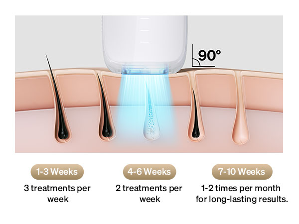 Amazon.com: Ulike 雷射除毛器男女皆宜Air 3 冰冷IPL 脫毛裝置