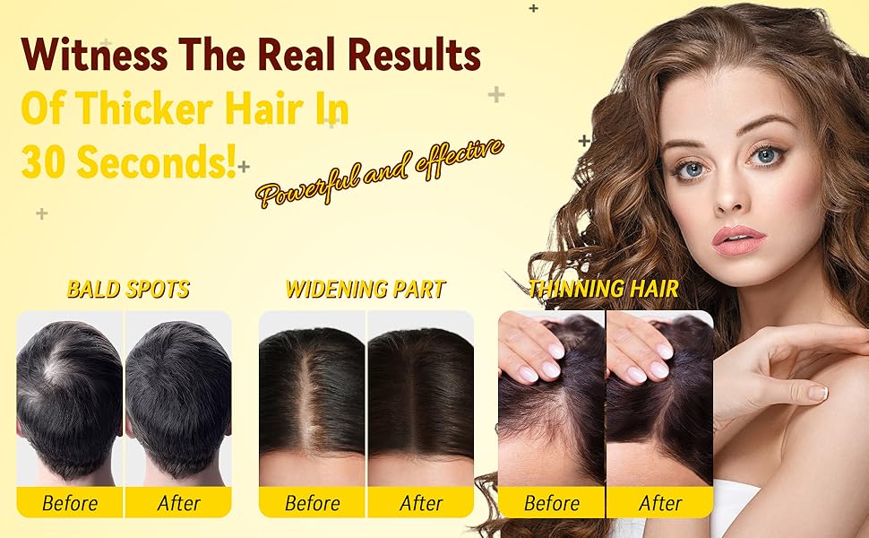 HOKING Hair Fibers for Thinning Hair Black, Hide Hair Loss & Look Thick Hair