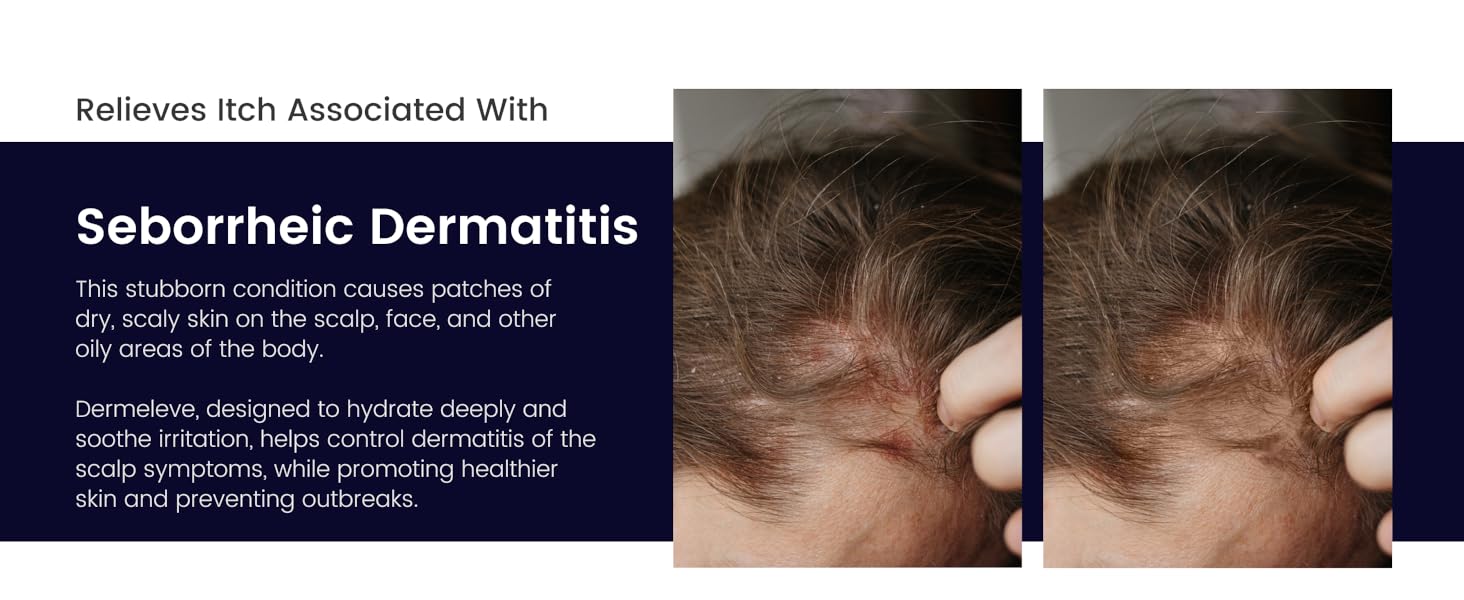 Dermeleve Anti-Itch Serum