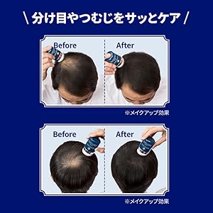 Amazon | アートネイチャー アートミクロンパウダー 20g 増え