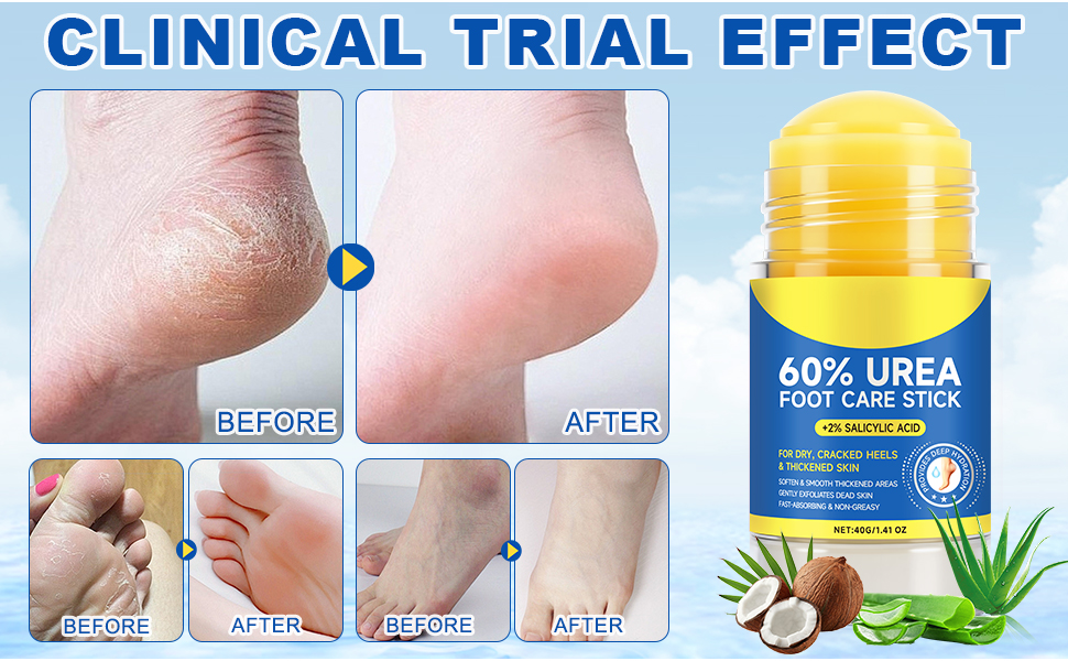 Urea Foot Care Stick & Cream