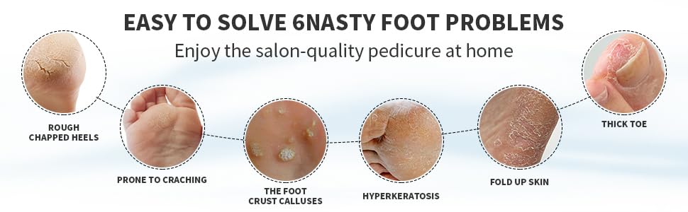 foot stone pedicure foot file foot files pumice file foot care