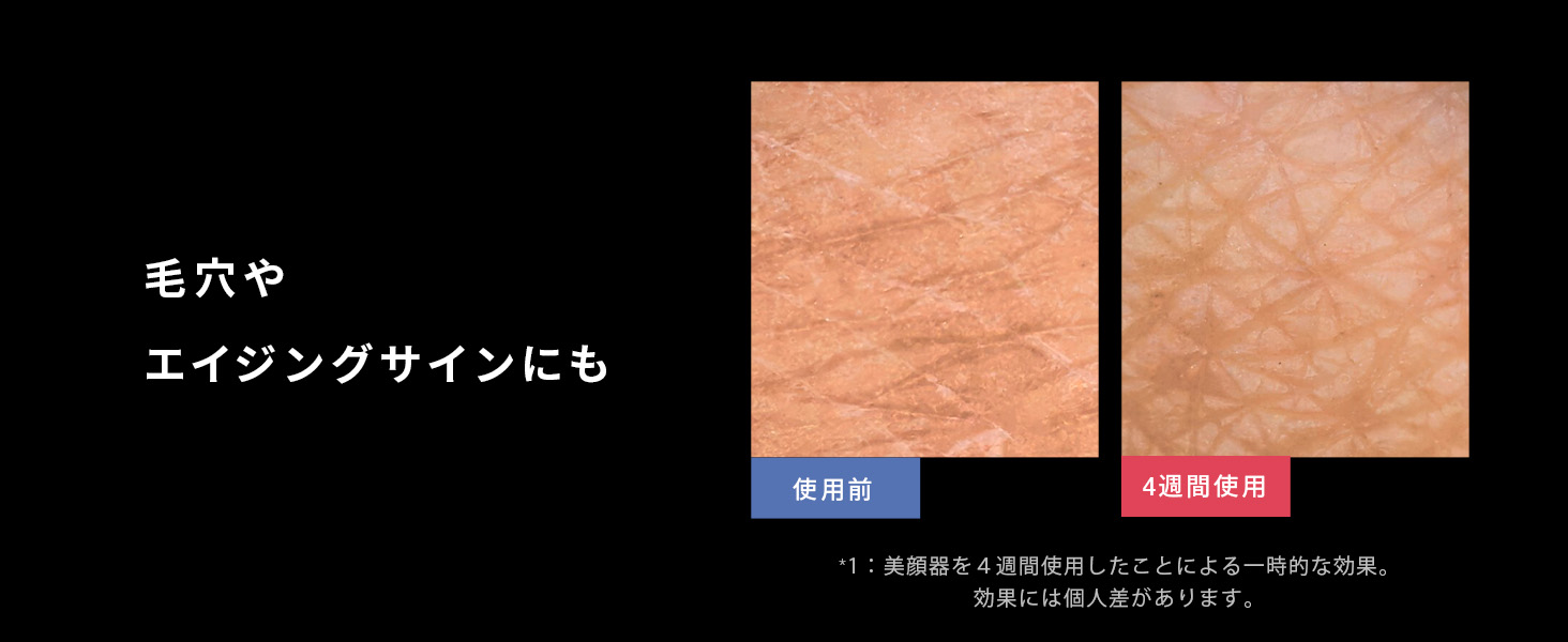また、毛穴や老化の兆候にも最適です